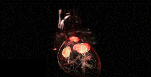  X光造影和心电3D构成的电脑图像